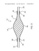 Mechanical Embolectomy Device and Method diagram and image