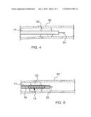 Mechanical Embolectomy Device and Method diagram and image