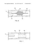 Mechanical Embolectomy Device and Method diagram and image