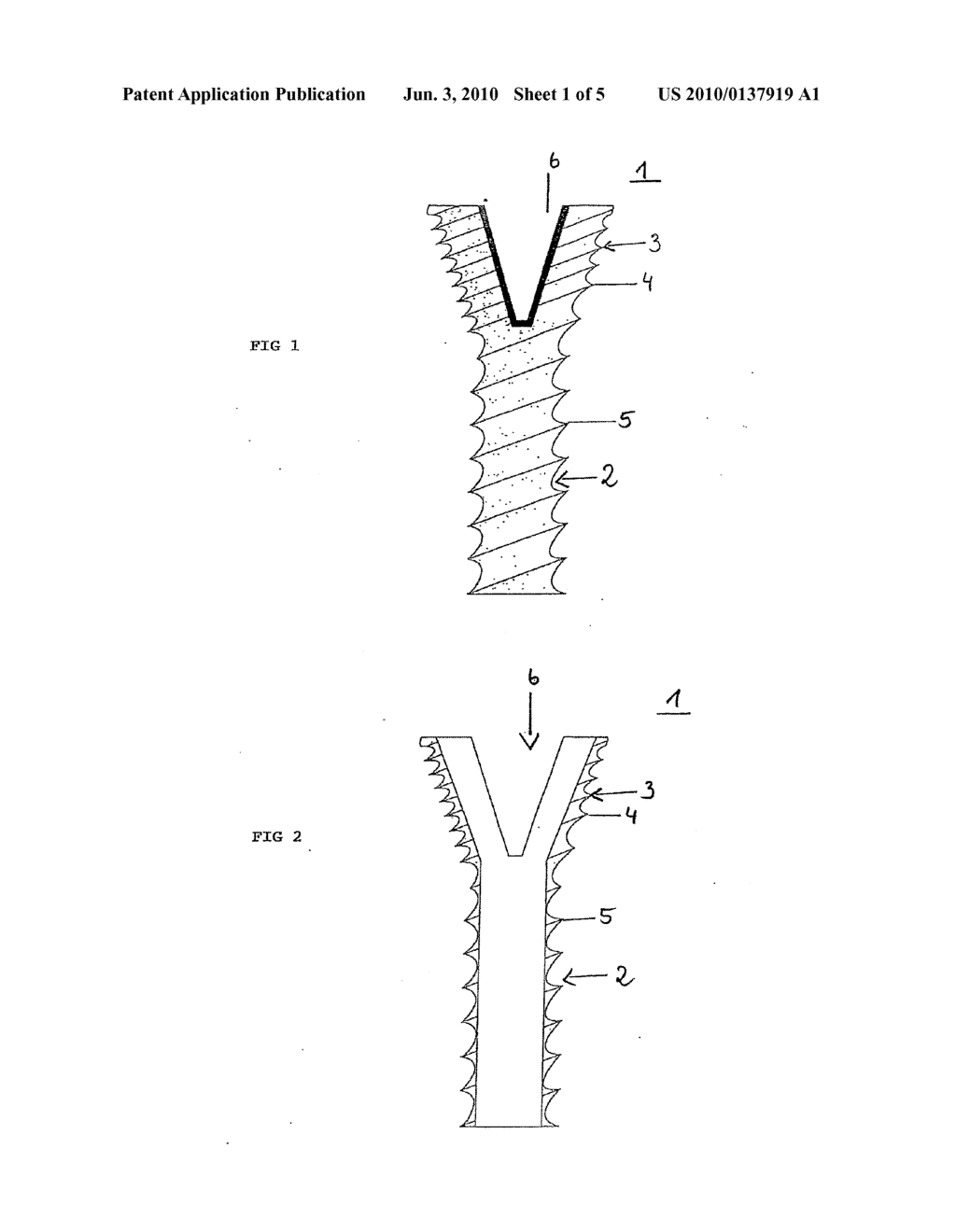 BONE SCREW - diagram, schematic, and image 02