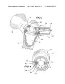 MINIMALLY INVASIVE ORTHOPAEDIC DELIVERY DEVICES AND TOOLS diagram and image