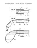 MINIMALLY INVASIVE ORTHOPAEDIC DELIVERY DEVICES AND TOOLS diagram and image