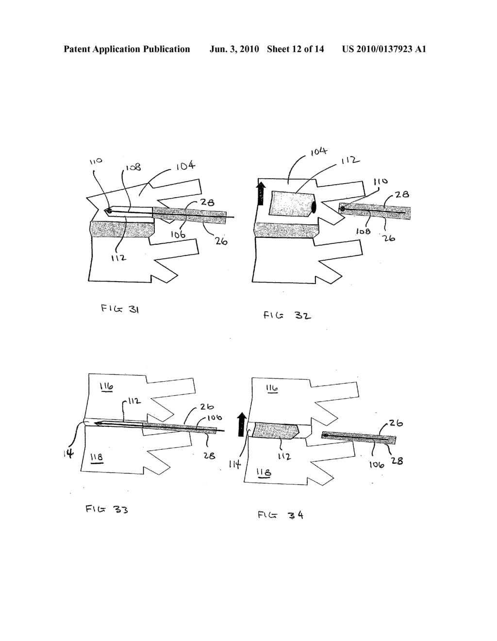 MINIMALLY INVASIVE ORTHOPAEDIC DELIVERY DEVICES AND TOOLS - diagram, schematic, and image 13