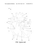 MULTIFUNCTIONAL CARDIAC PACEMAKER SYSTEM diagram and image