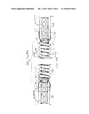 IMPLANTABLE LEAD diagram and image