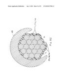 IMPLANTABLE LEAD diagram and image