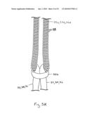 IMPLANTABLE LEAD diagram and image