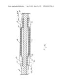 IMPLANTABLE LEAD diagram and image