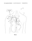 IMPLANTABLE MEDICAL DEVICE INCLUDING A PLURALITY OF LEAD CONNECTION ASSEMBLIES diagram and image