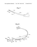 Subcutaneous Electrode with Improved Contact Shape for Transthoracic Conduction diagram and image