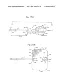 Subcutaneous Electrode with Improved Contact Shape for Transthoracic Conduction diagram and image