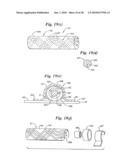 Subcutaneous Electrode with Improved Contact Shape for Transthoracic Conduction diagram and image