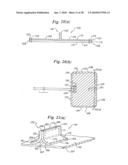 Subcutaneous Electrode with Improved Contact Shape for Transthoracic Conduction diagram and image