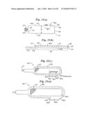 Subcutaneous Electrode with Improved Contact Shape for Transthoracic Conduction diagram and image