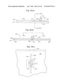 Subcutaneous Electrode with Improved Contact Shape for Transthoracic Conduction diagram and image