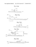 Subcutaneous Electrode with Improved Contact Shape for Transthoracic Conduction diagram and image