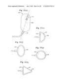 Subcutaneous Electrode with Improved Contact Shape for Transthoracic Conduction diagram and image