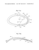 Subcutaneous Electrode with Improved Contact Shape for Transthoracic Conduction diagram and image