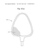 Subcutaneous Electrode with Improved Contact Shape for Transthoracic Conduction diagram and image