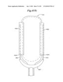 Subcutaneous Electrode with Improved Contact Shape for Transthoracic Conduction diagram and image