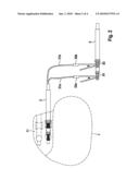 ADAPTER, ADAPTER RETAIL UNIT AND SYSTEM OF THE ADAPTER, AN IMPLANTABLE MEDICAL ELECTRONIC DEVICE AND AN ELECTRODE LINE diagram and image