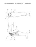 PERCUTANEOUS CONTINUAL ELECTRO-ACUPUNCTURE STIMULATION FOR IN VIVO AND IN SITU TISSUE ENGINEERING diagram and image