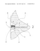 PERCUTANEOUS CONTINUAL ELECTRO-ACUPUNCTURE STIMULATION FOR IN VIVO AND IN SITU TISSUE ENGINEERING diagram and image