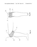 PERCUTANEOUS CONTINUAL ELECTRO-ACUPUNCTURE STIMULATION FOR IN VIVO AND IN SITU TISSUE ENGINEERING diagram and image