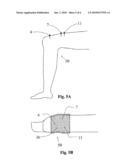 PERCUTANEOUS CONTINUAL ELECTRO-ACUPUNCTURE STIMULATION FOR IN VIVO AND IN SITU TISSUE ENGINEERING diagram and image