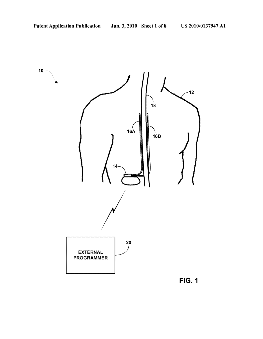 PATIENT PROGRAMMER WITH AUTOMATED MRI COMPATIBILITY VERIFICATION FOR ACTIVE IMPLANTABLE MEDICAL DEVICE - diagram, schematic, and image 02