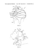 METHOD AND APPARATUS FOR REDUCING BODY TEMPERATURE OF A SUBJECT diagram and image