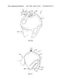 METHOD AND APPARATUS FOR REDUCING BODY TEMPERATURE OF A SUBJECT diagram and image