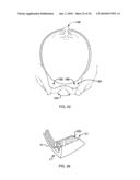 METHOD AND APPARATUS FOR REDUCING BODY TEMPERATURE OF A SUBJECT diagram and image