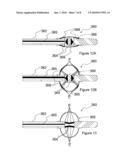 APPARATUSES FOR THERMALLY-INDUCED RENAL NEUROMODULATION diagram and image