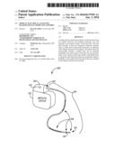 MEDICAL ELECTRICAL LEAD WITH BACKFILLED ELECTRODE SUB-ASSEMBLY diagram and image