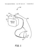 MEDICAL ELECTRICAL LEAD WITH BACKFILLED ELECTRODE SUB-ASSEMBLY diagram and image