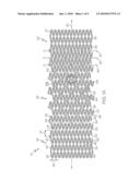 Stent with Graduated Stiffness diagram and image