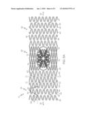 Stent with Graduated Stiffness diagram and image