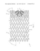 Stent with Graduated Stiffness diagram and image