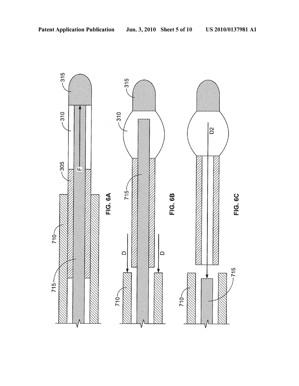 OCULAR IMPLANT WITH SHAPE CHANGE CAPABILITIES - diagram, schematic, and image 06