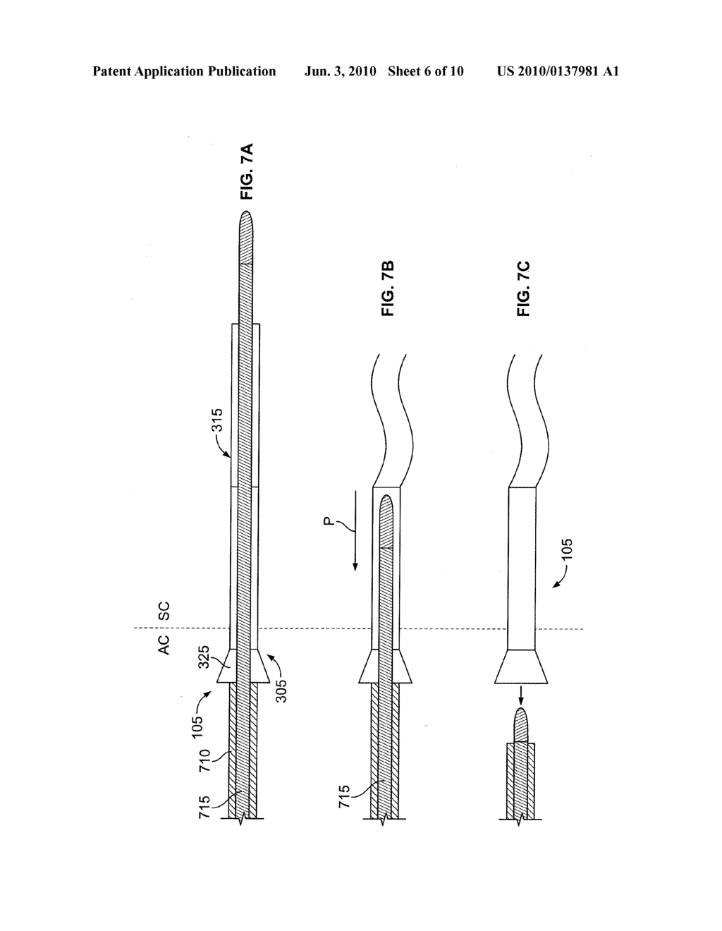 OCULAR IMPLANT WITH SHAPE CHANGE CAPABILITIES - diagram, schematic, and image 07