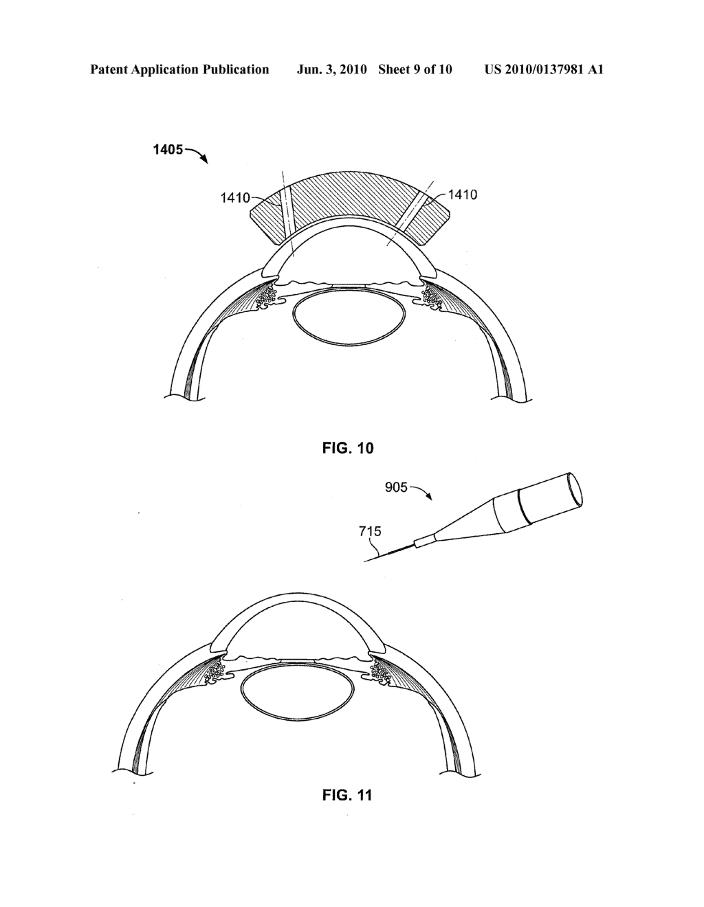 OCULAR IMPLANT WITH SHAPE CHANGE CAPABILITIES - diagram, schematic, and image 10