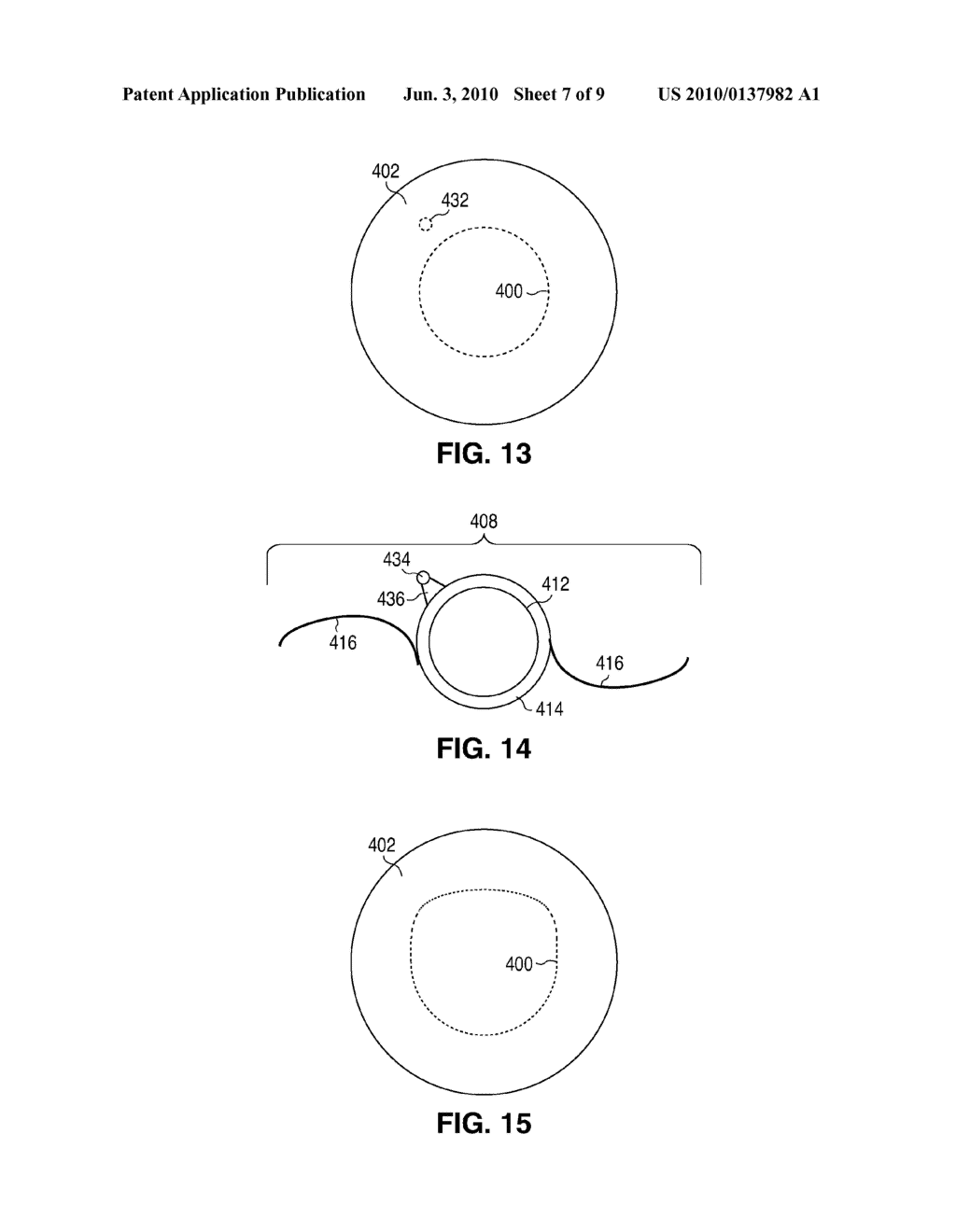 Method For Creating Incisions To Improve Intraocular Lens Placement - diagram, schematic, and image 08