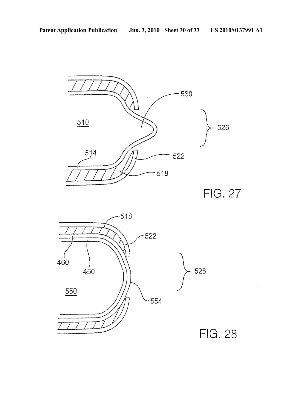 PROSTHETIC NUCLEUS WITH A PREFORMED MEMBRANE - diagram, schematic, and image 31