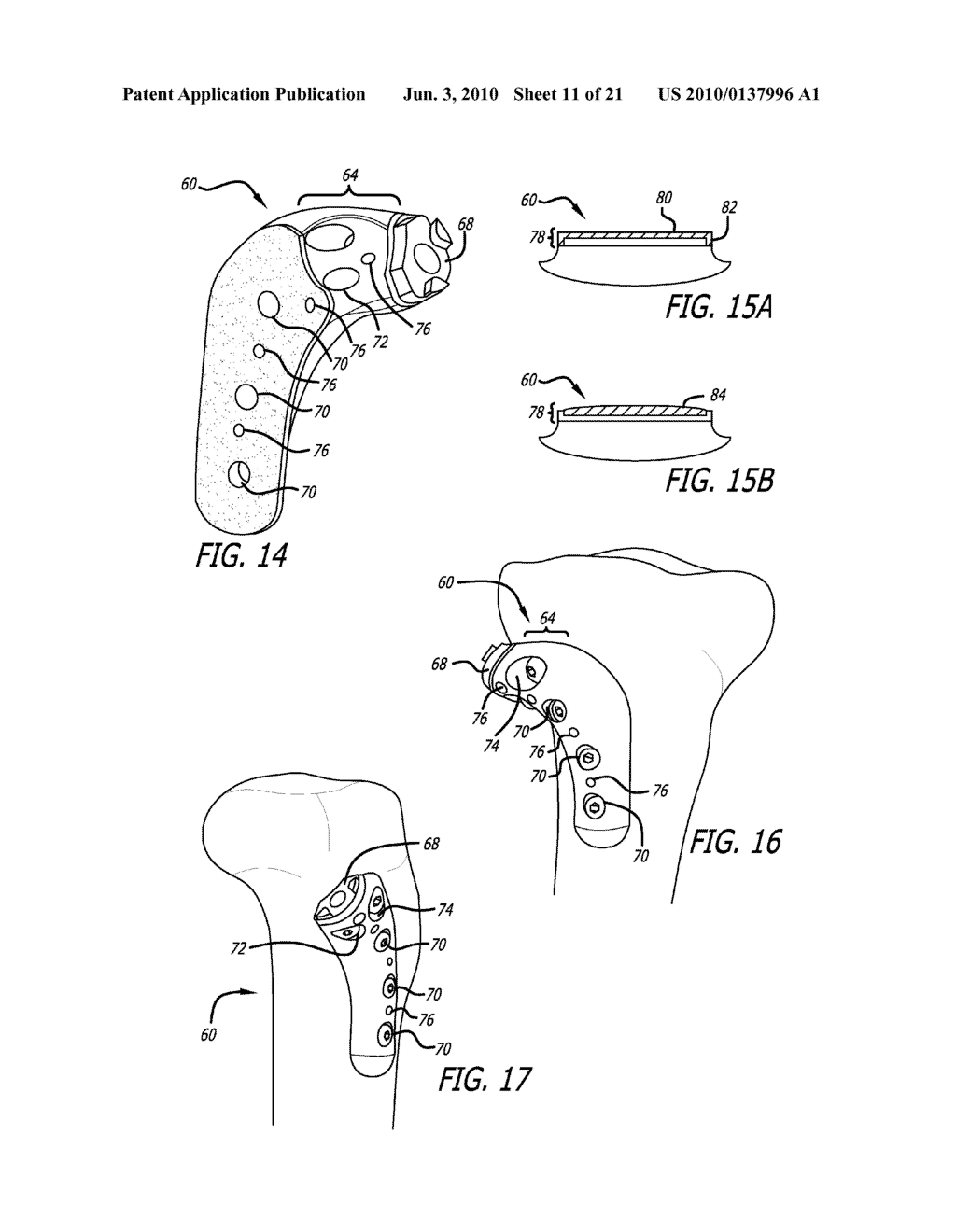 FEMORAL AND TIBIAL BASE COMPONENTS - diagram, schematic, and image 12