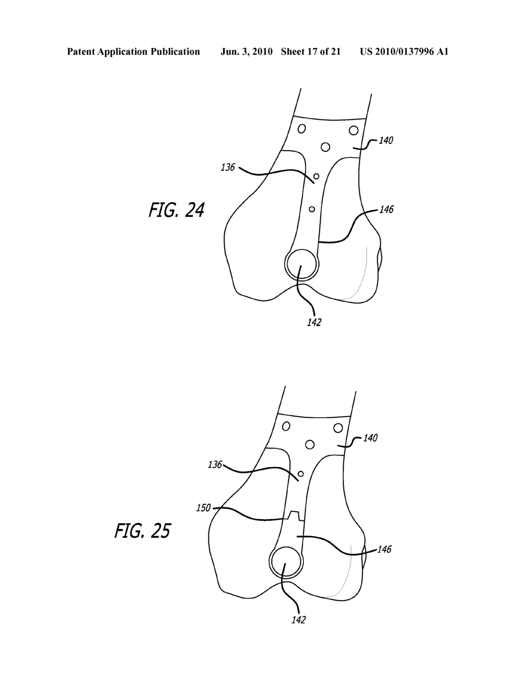 FEMORAL AND TIBIAL BASE COMPONENTS - diagram, schematic, and image 18