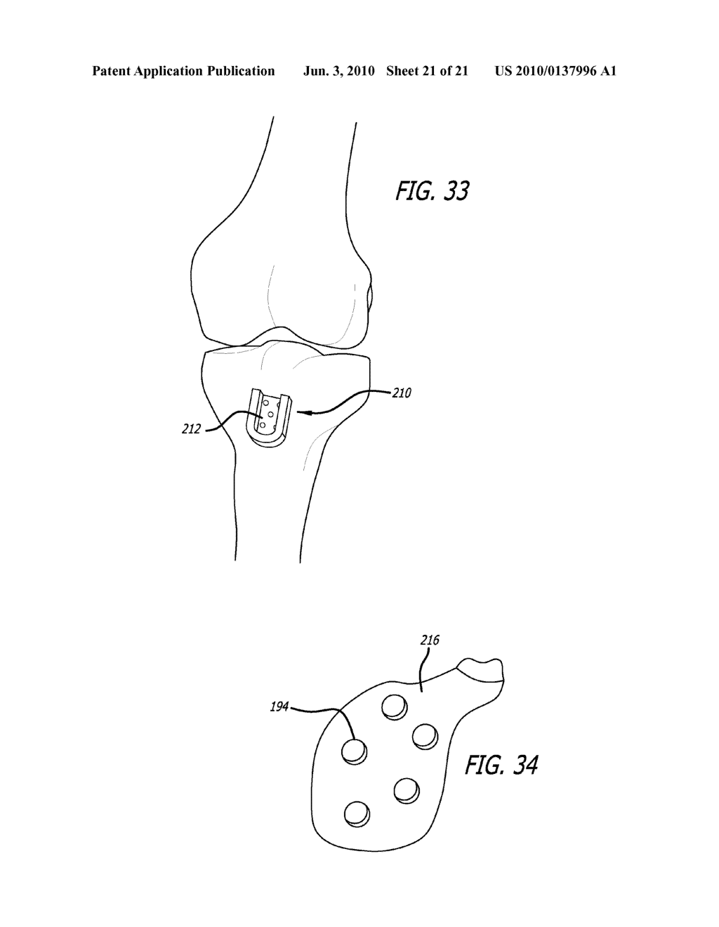 FEMORAL AND TIBIAL BASE COMPONENTS - diagram, schematic, and image 22