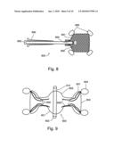 SOFT TISSUE FIXATION DEVICES diagram and image