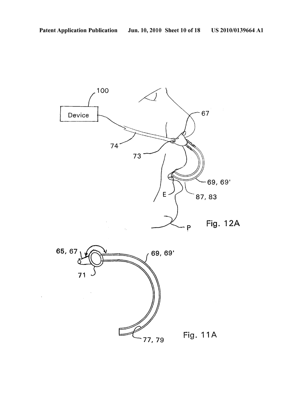 NASAL AND ORAL CANNULA HAVING TWO CAPABILITIES AND METHOD OF PRODUCING SAME - diagram, schematic, and image 11