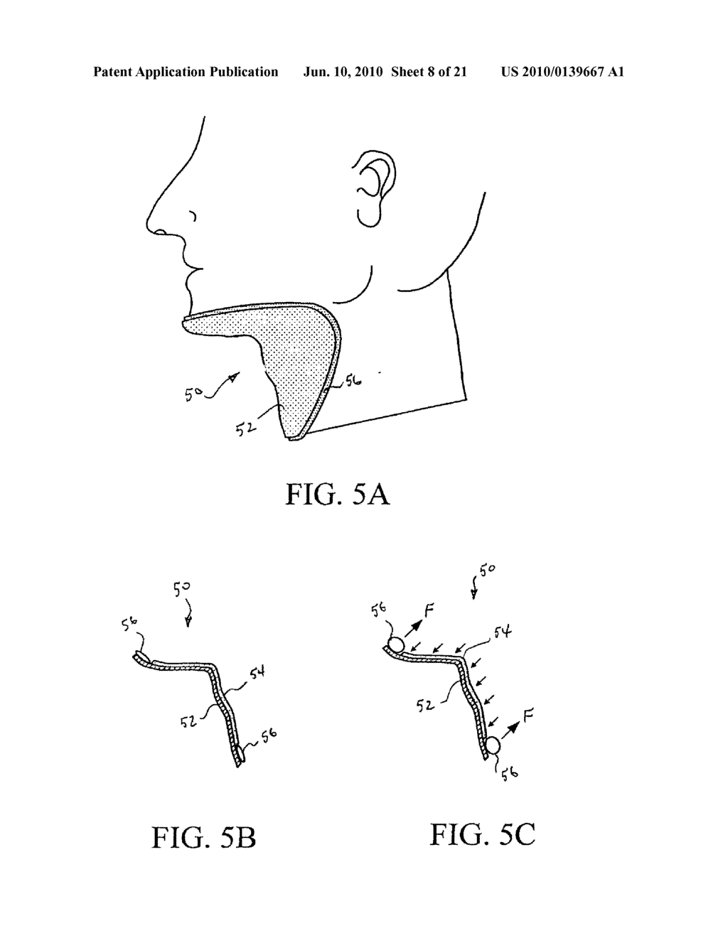 DEVICES AND METHODS FOR TREATING SLEEP DISORDERS - diagram, schematic, and image 09